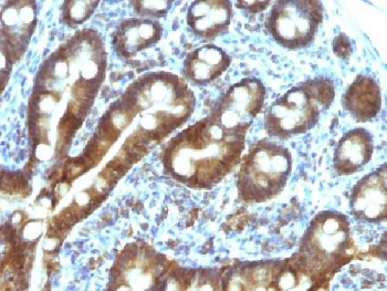 TDP2 Antibody / ETS1 associated protein II