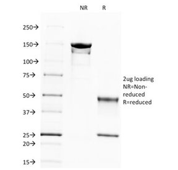 SPTBN2 Antibody / Spectrin beta III