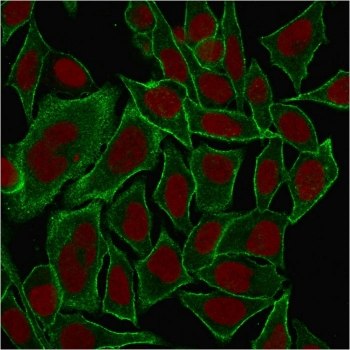 SPTBN2 Antibody / Spectrin beta III