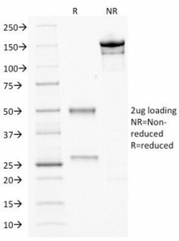 CDX2 Antibody