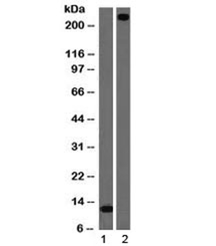 von Willebrand Factor Antibody / vWF
