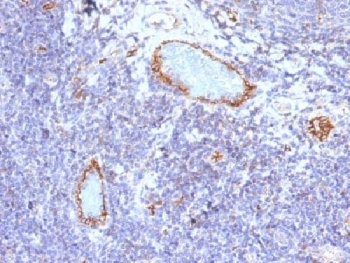 von Willebrand Factor Antibody / vWF