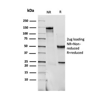 S100B Antibody