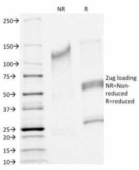 CFTR Antibody / Cystic Fibrosis Transmembrane Regulator