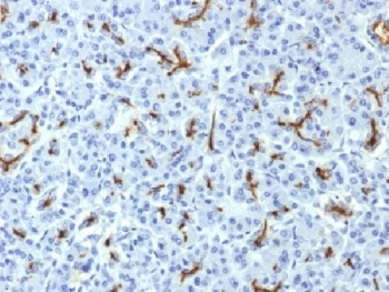 CFTR Antibody / Cystic Fibrosis Transmembrane Regulator