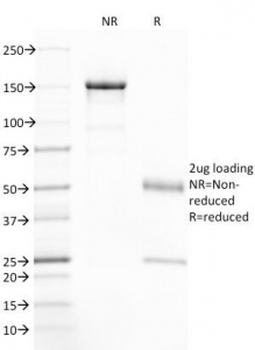 CFTR Antibody / Cystic Fibrosis Transmembrane Regulator