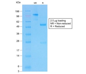 CFTR Antibody / Cystic Fibrosis Transmembrane Regulator