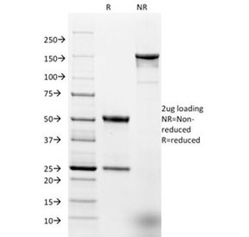 EpCAM Antibody
