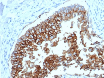 EpCAM Antibody
