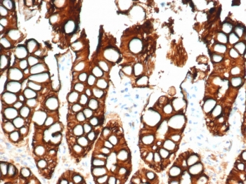 EpCAM Antibody