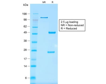 EpCAM Antibody