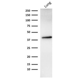 EpCAM Antibody