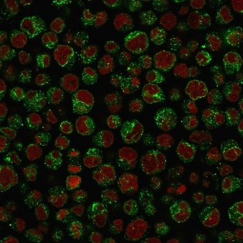 CD79a Antibody