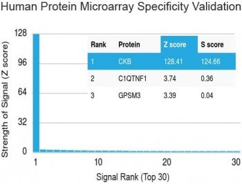 Creatine kinase B Antibody / CKB