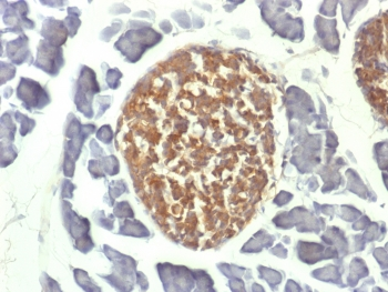 NSE Antibody / Neuron Specific Enolase