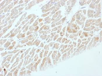 NSE Antibody / Neuron Specific Enolase