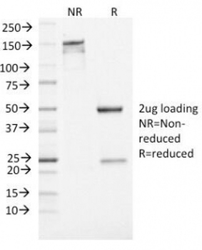 NSE Antibody / Neuron Specific Enolase