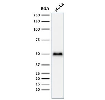 p53 Antibody / TP53