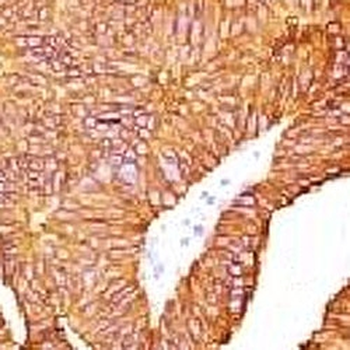 EpCAM Antibody