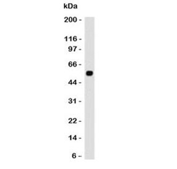p53 Antibody / TP53