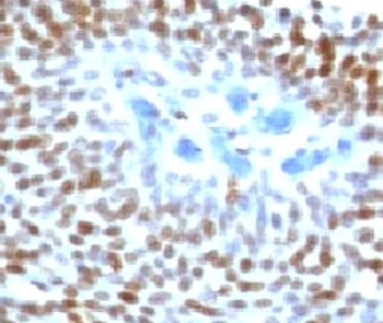 p53 Antibody / TP53