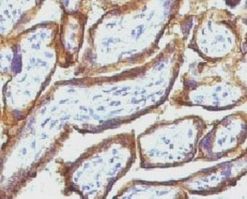 EGF Receptor / EGFR Antibody