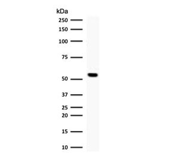 TOP1MT Antibody / Topoisomerase I mitochondrial