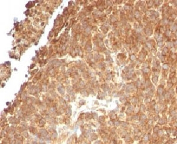 TOP1MT Antibody / Topoisomerase I mitochondrial