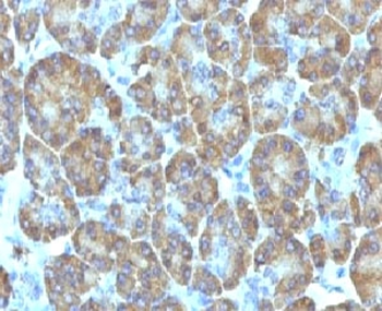 TOP1MT Antibody / Topoisomerase I mitochondrial