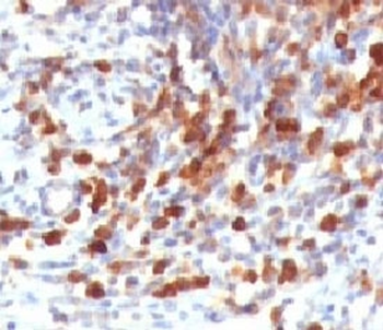 CD79a Antibody