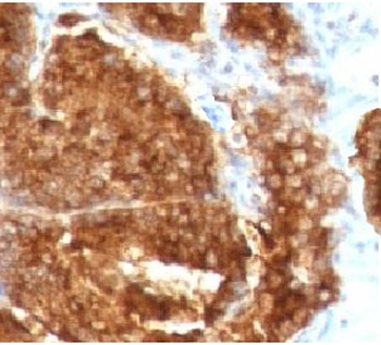 TAG-72 Antibody