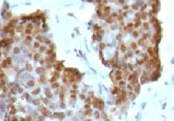 Estrogen Receptor beta Antibody