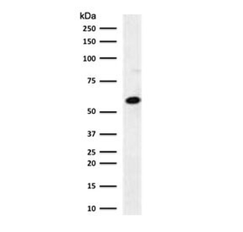 Estrogen Receptor beta Antibody