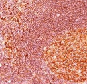 MALT1 Antibody