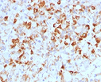 LHB Antibody / Luteinizing Hormone beta