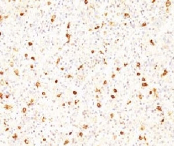 LHB Antibody / Luteinizing Hormone beta