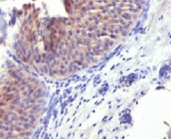 KRT10 Antibody / Cytokeratin 10