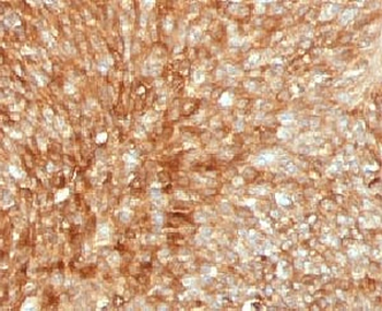 Beta-2 Microglobulin Antibody