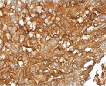 Beta-2 Microglobulin Antibody