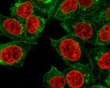 Beta-2 Microglobulin Antibody