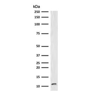 Beta-2 Microglobulin Antibody