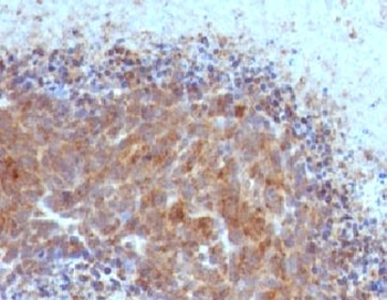 Bax Antibody