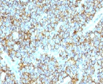 CD99 Antibody