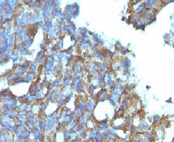 CD99 Antibody