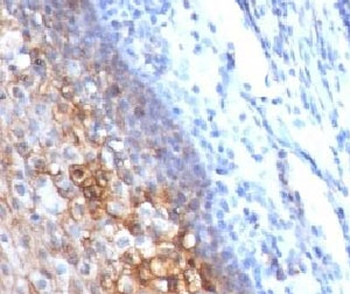 CD146 Antibody / MCAM / MUC18