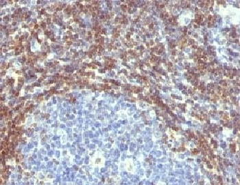 Bcl-2 Antibody
