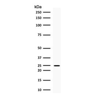 PGP9.5 / UchL1 Antibody