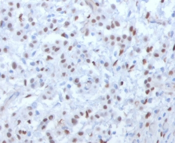 WT1 Antibody