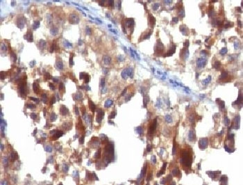 CD63 Antibody / LAMP-3