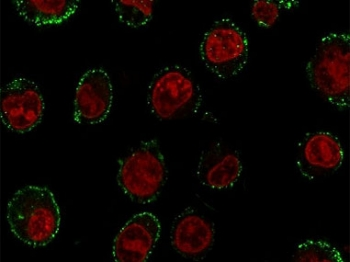 CD74 / CLIP Antibody